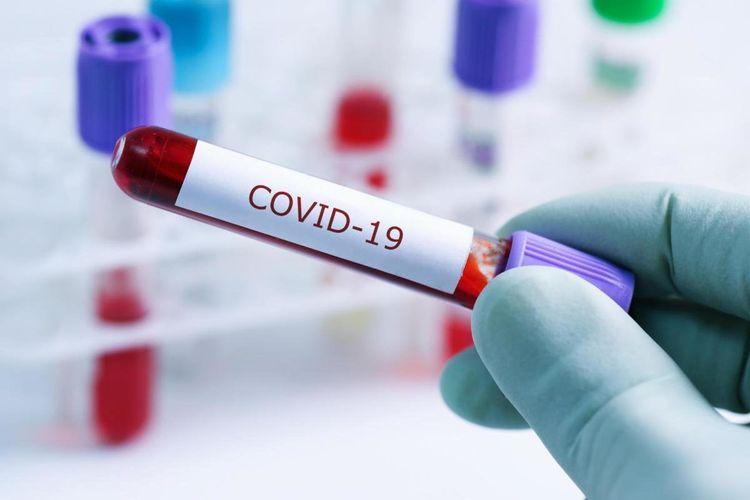Azərbaycanda daha 12 nəfərdə koronavirus aşkarlandı -