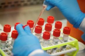 ABŞ koronavirusu sürətlə aşkarlayan testə lisenziya verdi